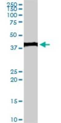 Western Blot: Evx1 Antibody (1B7) [H00002128-M07]