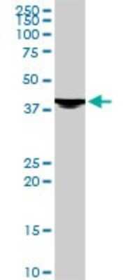 Western Blot: Evx1 Antibody (1B7) [H00002128-M07]