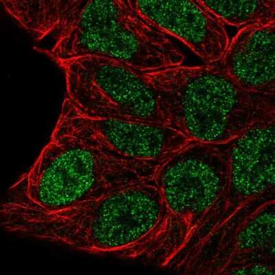 Immunocytochemistry/ Immunofluorescence: Evx1 Antibody [NBP2-55442]