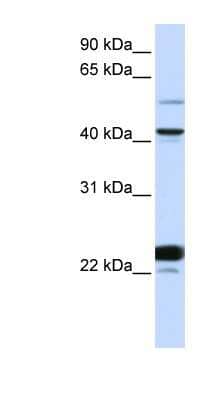 Western Blot: Evx1 Antibody [NBP1-79701]