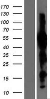 Western Blot: Evx1 Overexpression Lysate [NBL1-10370]