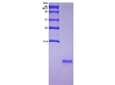 SDS-PAGE: Recombinant Exendin-4 Protein [NBP2-34945]