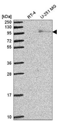 Western Blot: Exonuclease 1 Antibody [NBP2-58299]