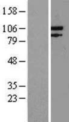 Western Blot: Exonuclease 1 Overexpression Lysate [NBP2-05746]
