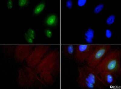 Immunocytochemistry/ Immunofluorescence: Exosome Component 9 Antibody - BSA Free [NBP1-71702]