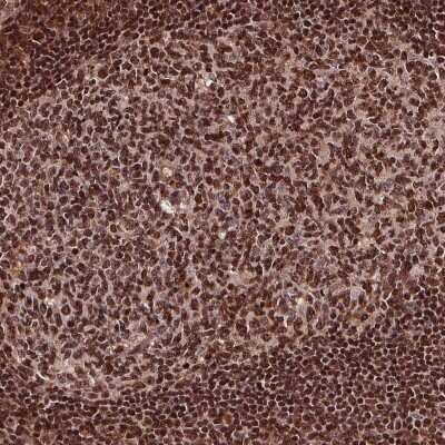 Immunohistochemistry-Paraffin: Exosome Component 9 Antibody [NBP2-57565]