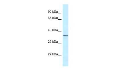 Western Blot: Exosome Component 9 Antibody [NBP2-87379]