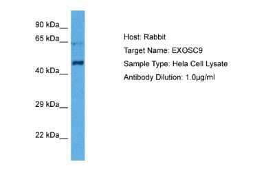 Western Blot: Exosome Component 9 Antibody [NBP2-87380]