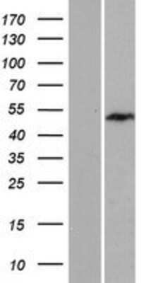 Western Blot: Exosome Component 9 Overexpression Lysate [NBP2-10617]