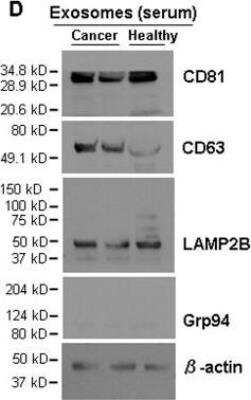 Western Blot: Exosome Detection (Western Blot) Antibody Pack [NBP3-11740]