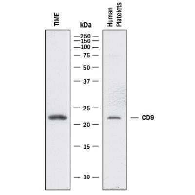 Western Blot: Exosome Detection (Western Blot) Antibody Pack [NBP3-11740]