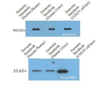 Western Blot: Exosome Standards (COLO1 cell line) [NBP2-49845]