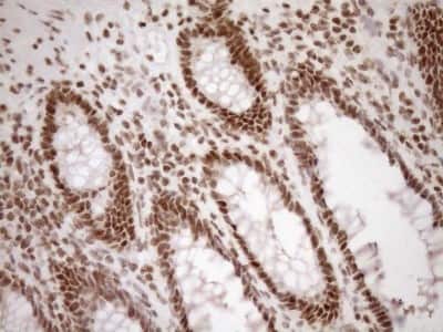 Immunohistochemistry: Exosome component 1 Antibody (OTI1H9) [NBP2-45545]