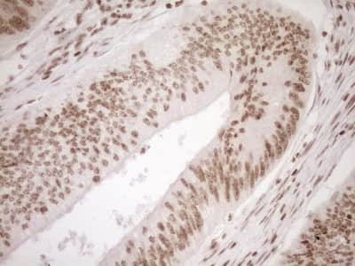 Immunohistochemistry: Exosome component 1 Antibody (OTI1H9) [NBP2-45545]