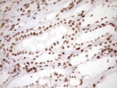 Immunohistochemistry: Exosome component 1 Antibody (OTI1H9) [NBP2-45545]