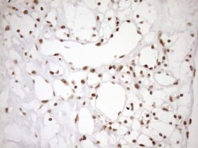 Immunohistochemistry: Exosome component 1 Antibody (OTI1H9) [NBP2-45545]