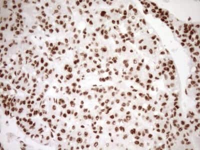 Immunohistochemistry: Exosome component 1 Antibody (OTI1H9) [NBP2-45545]