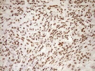 Immunohistochemistry: Exosome component 1 Antibody (OTI1H9) [NBP2-45545]