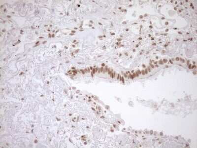 Immunohistochemistry: Exosome component 1 Antibody (OTI1H9) [NBP2-45545]