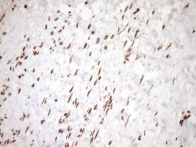 Immunohistochemistry: Exosome component 1 Antibody (OTI1H9) [NBP2-45545]