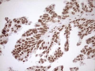 Immunohistochemistry: Exosome component 1 Antibody (OTI1H9) [NBP2-45545]