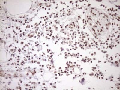 Immunohistochemistry: Exosome component 1 Antibody (OTI1H9) [NBP2-45545]