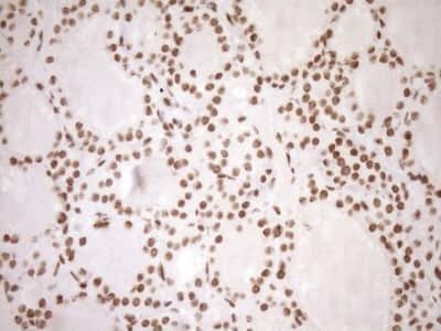 Immunohistochemistry: Exosome component 1 Antibody (OTI1H9) [NBP2-45545]