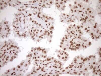 Immunohistochemistry: Exosome component 1 Antibody (OTI1H9) [NBP2-45545]