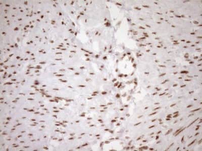 Immunohistochemistry: Exosome component 1 Antibody (OTI1H9) [NBP2-45545]