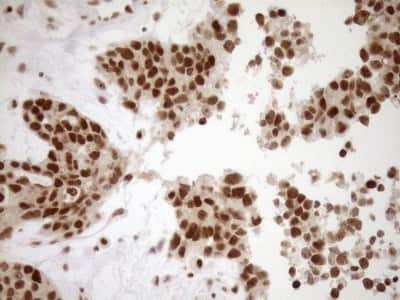 Immunohistochemistry: Exosome component 1 Antibody (OTI1H9) [NBP2-45545]