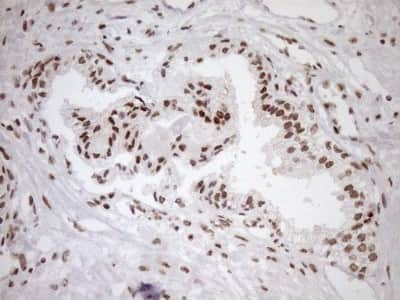 Immunohistochemistry: Exosome component 1 Antibody (OTI1H9) [NBP2-45545]