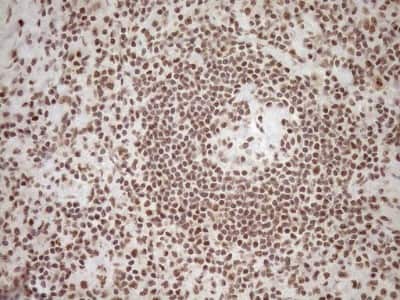 Immunohistochemistry: Exosome component 1 Antibody (OTI1H9) [NBP2-45545]