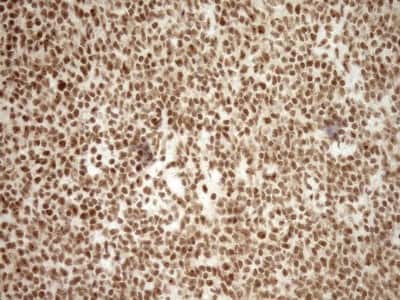 Immunohistochemistry: Exosome component 1 Antibody (OTI1H9) [NBP2-45545]