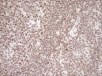 Immunohistochemistry: Exosome component 1 Antibody (OTI1H9) [NBP2-45545]