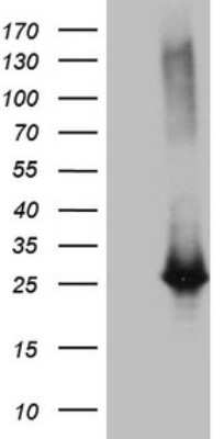 Western Blot: Exosome component 1 Antibody (OTI1H9) [NBP2-45545]