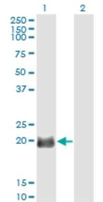 Western Blot: Exosome component 1 Antibody (2E9) [H00051013-M01]