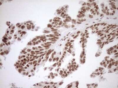 Immunohistochemistry: Exosome component 1 Antibody (OTI1H9) - Azide and BSA Free [NBP2-71895]