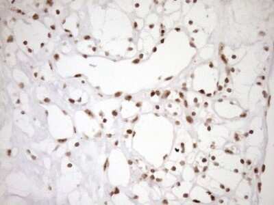 Immunohistochemistry: Exosome component 1 Antibody (OTI1H9) - Azide and BSA Free [NBP2-71895]