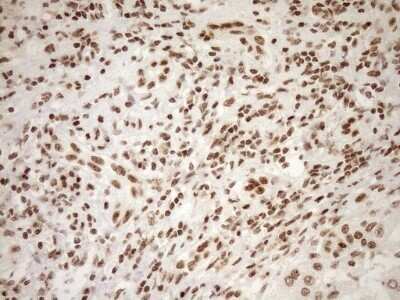Immunohistochemistry: Exosome component 1 Antibody (OTI1H9) - Azide and BSA Free [NBP2-71895]