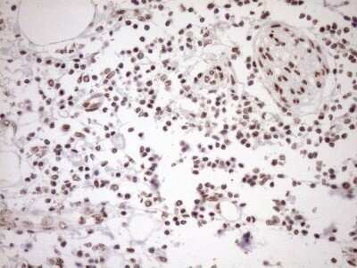 Immunohistochemistry: Exosome component 1 Antibody (OTI1H9) - Azide and BSA Free [NBP2-71895]