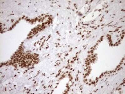 Immunohistochemistry: Exosome component 1 Antibody (OTI1H9) - Azide and BSA Free [NBP2-71895]