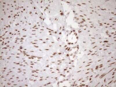 Immunohistochemistry: Exosome component 1 Antibody (OTI1H9) - Azide and BSA Free [NBP2-71895]