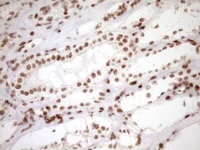 Immunohistochemistry: Exosome component 1 Antibody (OTI1H9) - Azide and BSA Free [NBP2-71895]