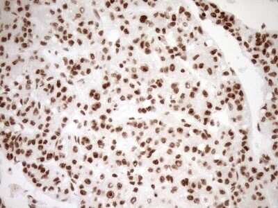 Immunohistochemistry: Exosome component 1 Antibody (OTI1H9) - Azide and BSA Free [NBP2-71895]