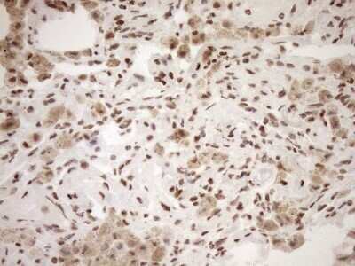 Immunohistochemistry: Exosome component 1 Antibody (OTI1H9) - Azide and BSA Free [NBP2-71895]