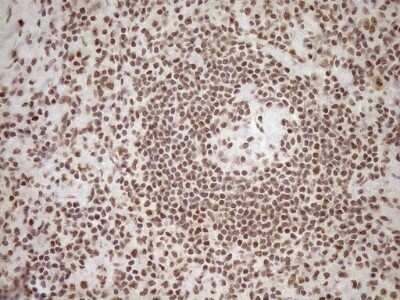 Immunohistochemistry: Exosome component 1 Antibody (OTI1H9) - Azide and BSA Free [NBP2-71895]