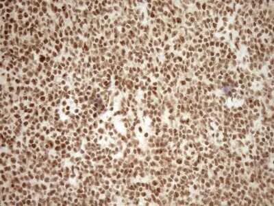 Immunohistochemistry: Exosome component 1 Antibody (OTI1H9) - Azide and BSA Free [NBP2-71895]