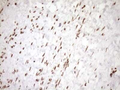 Immunohistochemistry: Exosome component 1 Antibody (OTI1H9) - Azide and BSA Free [NBP2-71895]