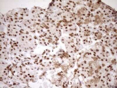 Immunohistochemistry: Exosome component 1 Antibody (OTI1H9) - Azide and BSA Free [NBP2-71895]