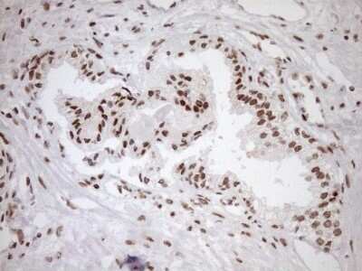 Immunohistochemistry: Exosome component 1 Antibody (OTI1H9) - Azide and BSA Free [NBP2-71895]